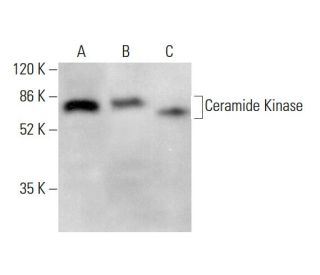 Ceramide Kinase Antibody (G-3) - Western Blotting - Image 379901 