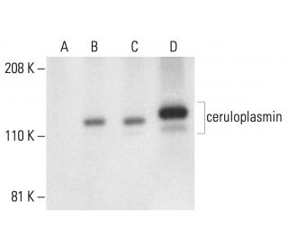 ceruloplasmin Antibody (H-3) - Western Blotting - Image 401915 