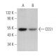 CES1 Antibody (B-4) - Western Blotting - Image 364677