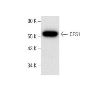 CES1 Antibody (E-1) - Western Blotting - Image 303410 