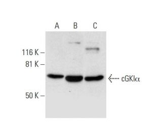 cGKI&alpha; Antibody (F-5) - Western Blotting - Image 300120 