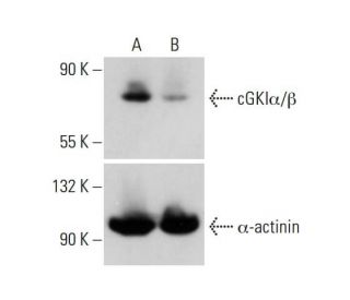 cGKI&alpha;/&beta; CRISPR/Cas9 KO Plasmid (h): sc-401593. Western blot analysis... 