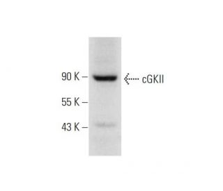cGKII Antibody (E-7) - Western Blotting - Image 290932 