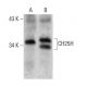 CH25H Antibody (1G8) - Western Blotting - Image 384012 