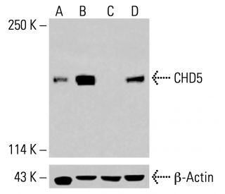 CHD5 Antibody (D-10) - Western Blotting - Image 413947Each CRISPR/Cas9 Knockout (KO) Plasmid product consists of a pool of 3 plasmids designed to ensure identification and cleavage of a specific gene for maximum knockout efficiency. Each plasmid encodes a unique 20 nt sequence derived from the GeCKO (v2) library.