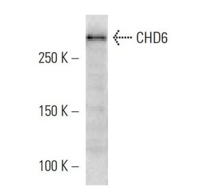 CHD6 Antibody (2174C2a) - Western Blotting - Image 16594 