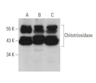 Chitotriosidase Antibody (A-11) - Western Blotting - Image 374654 