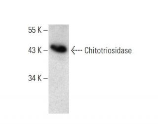 Chitotriosidase Antibody (A-3) - Western Blotting - Image 131246
