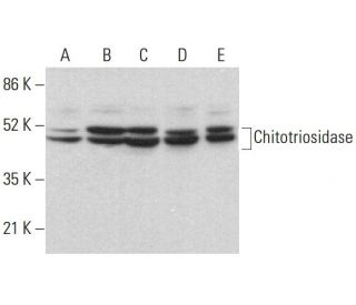 Chitotriosidase Antibody (A-11) - Western Blotting - Image 383716