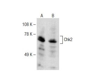 Chk2 Antibody (19) - Western Blotting - Image 149543 