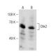 Chk2 Antibody (19) - Western Blotting - Image 149543 