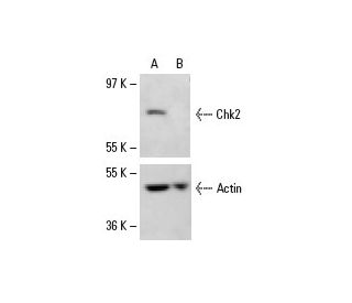 Chk2 Antibody (A-11) - Western Blotting - Image 6761 