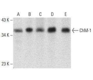 ChM-1 Antibody (H-10) - Western Blotting - Image 384474Each CRISPR/Cas9 Knockout (KO) Plasmid product consists of a pool of 3 plasmids designed to ensure identification and cleavage of a specific gene for maximum knockout efficiency. Each plasmid encodes a unique 20 nt sequence derived from the GeCKO (v2) library.