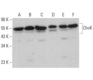 ChoK Antibody (B-6) - Western Blotting - Image 359133 