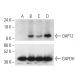 Cholecalciferol: sc-205630. Western blot analysis of DAP12 expression in untreated (A), PMA treated (B), Cholecalciferol t