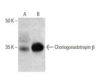 Choriogonadotropin &beta; Antibody (B-4) - Western Blotting - Image 358660 