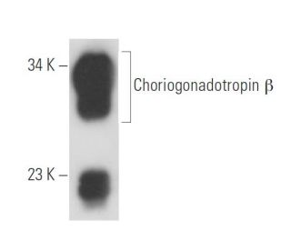 Choriogonadotropin &beta; Antibody (ME-107) - Western Blotting - Image 15815 