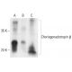 Choriogonadotropin β Antibody (ME-107) - Western Blotting - Image 401942