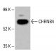 CHRNB4 Antibody (E-3) - Western Blotting - Image 415643