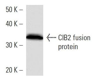 CIB2 Antibody (CIB2C12B11) - Western Blotting - Image 16915