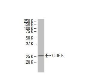 CIDE-B Antibody (5X) - Western Blotting - Image 34604SAM Transcription Activation: SAM system utilizing dCas9-VP64, MS2-P65-HSF1, and sgRNA for precise gene transcription activation.