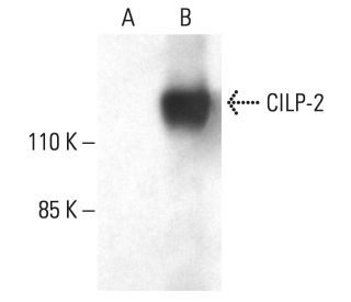 CILP-2 Antibody (B-1) - Western Blotting - Image 401951