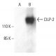 CILP-2 Antibody (B-1) - Western Blotting - Image 401951