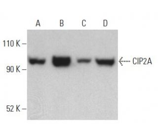 CIP2A Antibody (2G10-3B5) - Western Blotting - Image 399130 