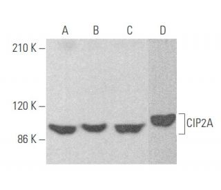 CIP2A Antibody (HL1916) - Western Blotting - Image 355603 
