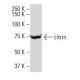 citrin Antibody (8Z) - Western Blotting - Image 34308 
