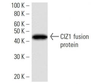 CIZ1 Antibody (2186C2a) - Western Blotting - Image 16513