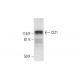 CIZ1 Antibody (A-6) - Western Blotting - Image 291973 