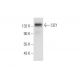 CIZ1 Antibody (A-6) - Western Blotting - Image 300508