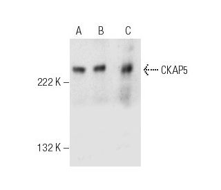 CKAP5 Antibody (H-4) - Western Blotting - Image 150235 
