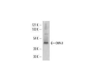 CKR-3 Antibody (5E8) - Western Blotting - Image 11658SAM Transcription Activation: SAM system utilizing dCas9-VP64, MS2-P65-HSF1, and sgRNA for precise gene transcription activation.