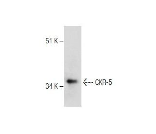 CKR-5 Antibody (E-6) - Western Blotting - Image 282609