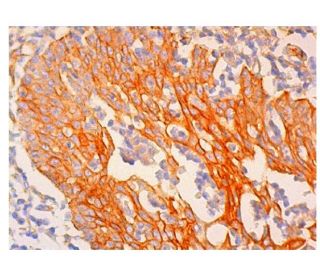 CKR-5 Antibody (R22/7) - Immunohistochemistry - Image 324333 