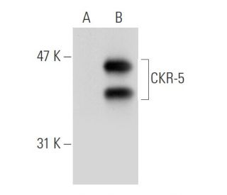 CKR-5 Antibody (R22/7) - Western Blotting - Image 38955