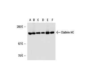 Clathrin Heavy Chain/CLTC Antibody (3F132) - Western Blotting - Image 15396 