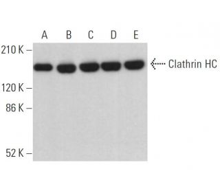 Clathrin Heavy Chain/CLTC Antibody (TD.1) - Western Blotting - Image 379351