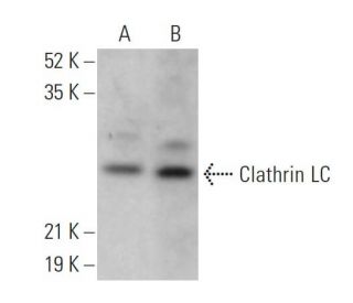 Clathrin Light Chain Antibody (CON.1) - Western Blotting - Image 359295The Double Nickase Plasmid features a U6 promoter for sgRNA expression, a 20 nt targeting sequence, and a gRNA scaffold to guide Cas9n. It includes a CBh promoter for Cas9n (D10A) and puromycin resistance, GFP for transfection verification, and nuclear localization signals (NLS). The 2A peptide allows co-expression of Cas9n and Puro from a single promoter, enabling precise genome editing with reduced off-target effects. 