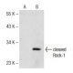 cleaved Rock-1 Antibody (154C1465) - Western Blotting - Image 141797