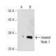 cleaved Rock-1 Antibody (4H247) - Western Blotting - Image 141798