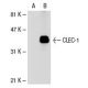 CLEC-1 Antibody (55Ex-2) - Western Blotting - Image 30836 