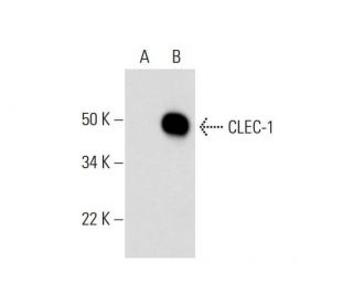 CLEC-1 Antibody (D-6) - Western Blotting - Image 294088