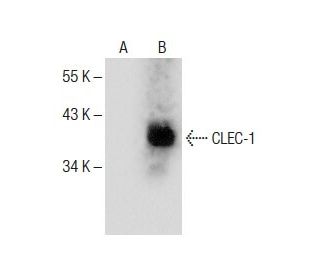 CLEC-1 Antibody (E-1) - Western Blotting - Image 285149
