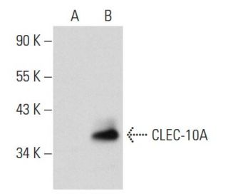 CLEC-10A Antibody (ER-MP23) - Western Blotting - Image 40721