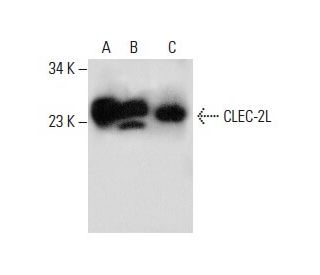 CLEC-2L Antibody (D-5) - Western Blotting - Image 288293 