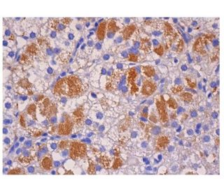 CLIP Antibody (cerCLIP.1) - Immunohistochemistry - Image 284908 