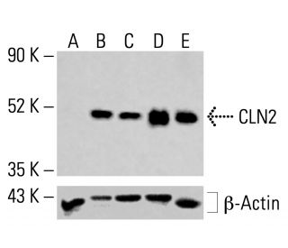 CLN2 Antibody (D-11) - Western Blotting - Image 414400 